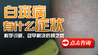 白癜风发病临床上会出现哪些症状